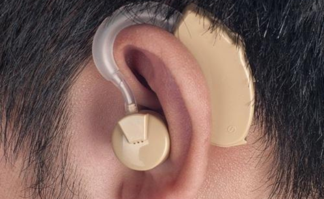 Hearing device 